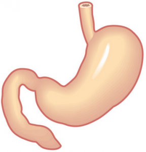 胃のポリープは食べ過ぎが原因