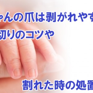 【新米ママ必見】赤ちゃんの爪は剥(は)がれやすい?爪切りのコツや割れた時の処置は?