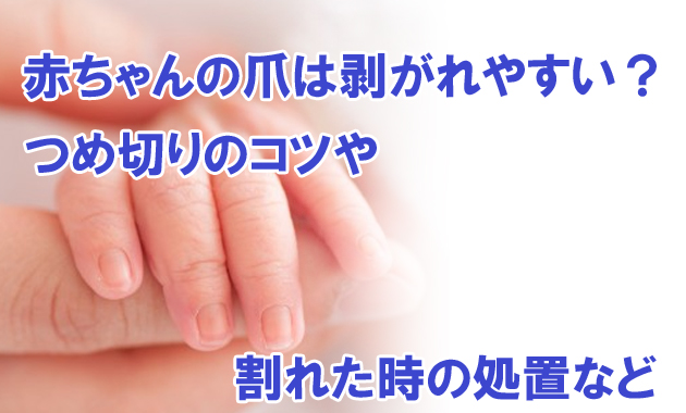 新米ママ必見 赤ちゃんの爪は剥 は がれやすい 爪切りのコツや割れた時の処置は