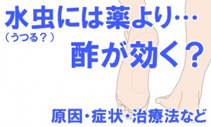 水虫には薬より酢が効く？そしてうつるのか？原因・症状｜治療のやり方など