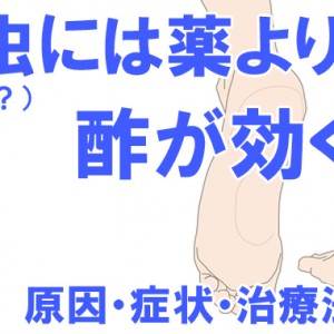 水虫には薬より酢が効く?そしてうつるのか?原因・症状|治療のやり方など