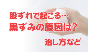 股ずれで起こる黒ずみの原因は？治し方など