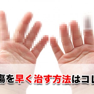 切り傷の時に早く治す処置方法はコレ!深い傷・化膿の場合は何科に行けばいい?